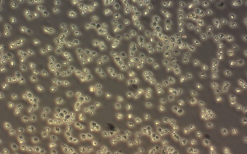 Phaeocystis - 3 -NordsjÃ¸en apr 2015
